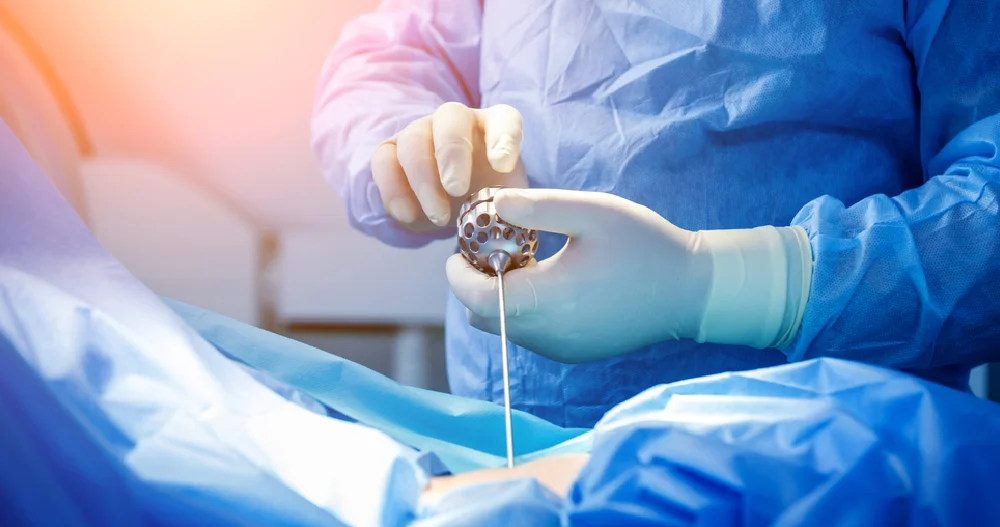 Spine Surgery & Treatment in Ahmedabad